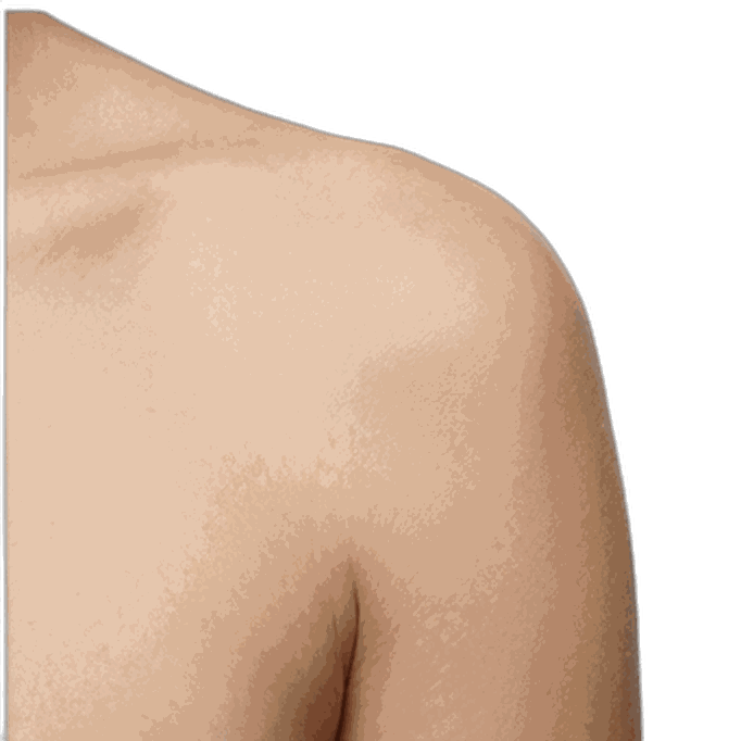Shoulder