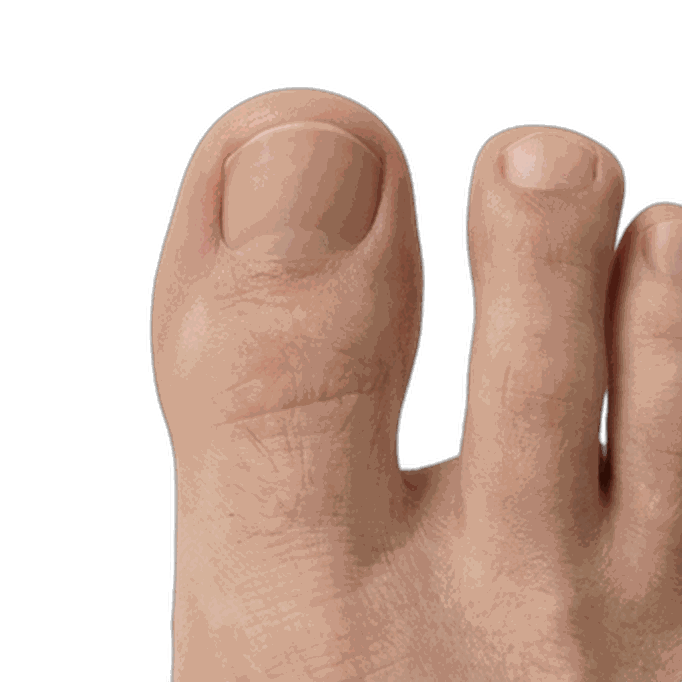 Toe